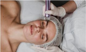 Fractional Laser: Στοχευμένη Ανάπλαση Δέρματος